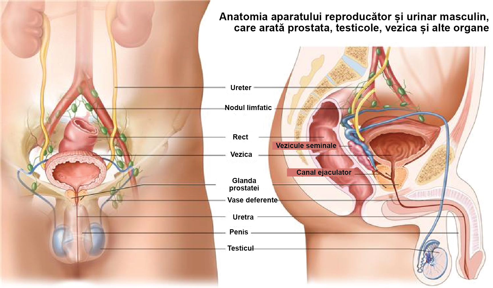 suport de scaun pentru prostatită rmn multiparamétrica de próstata